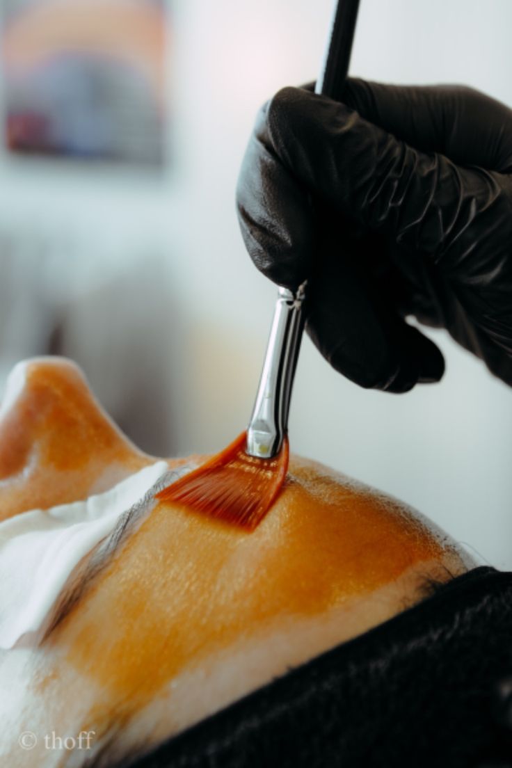 Chemical Peel With Retiflash Ll Facial Treatment