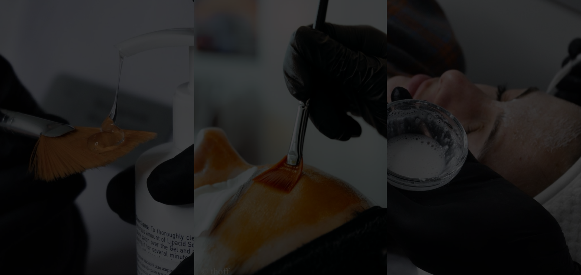 chemical peel top skin clinic
