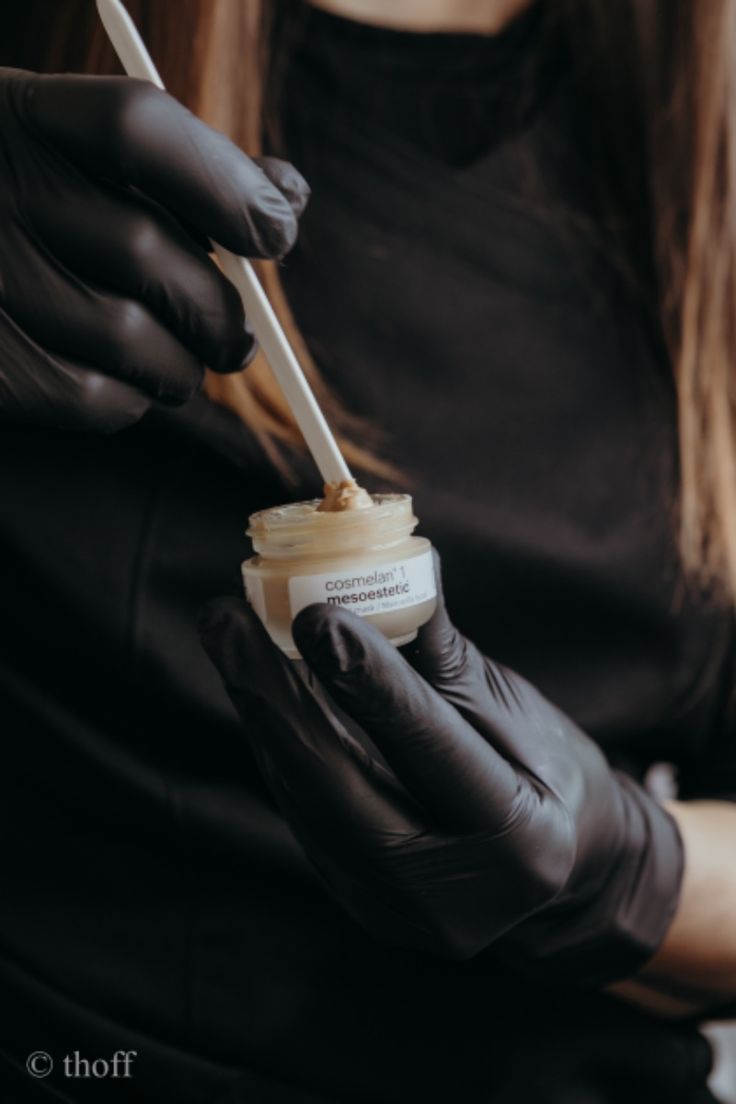 chemical-peel