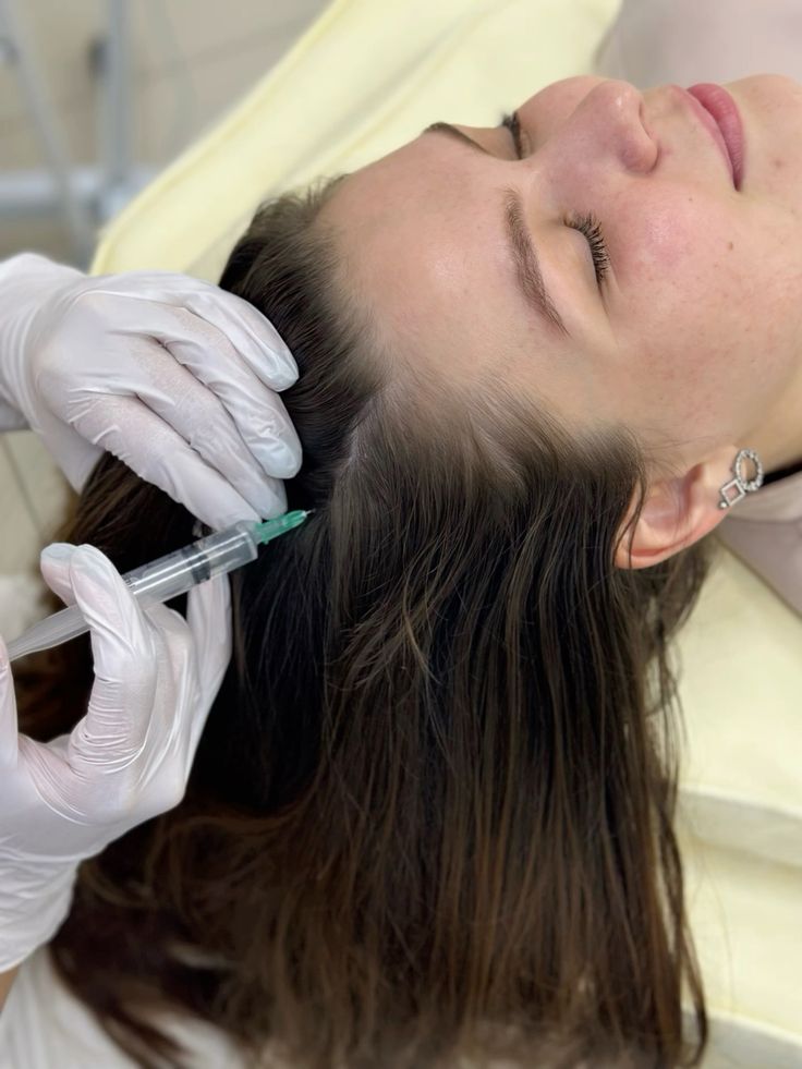 Мезотерапия головы