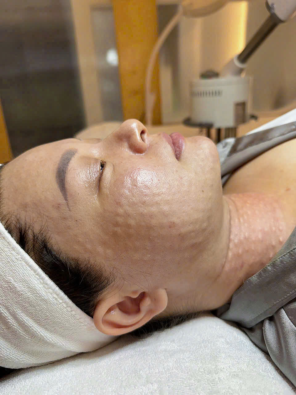 skin-booster