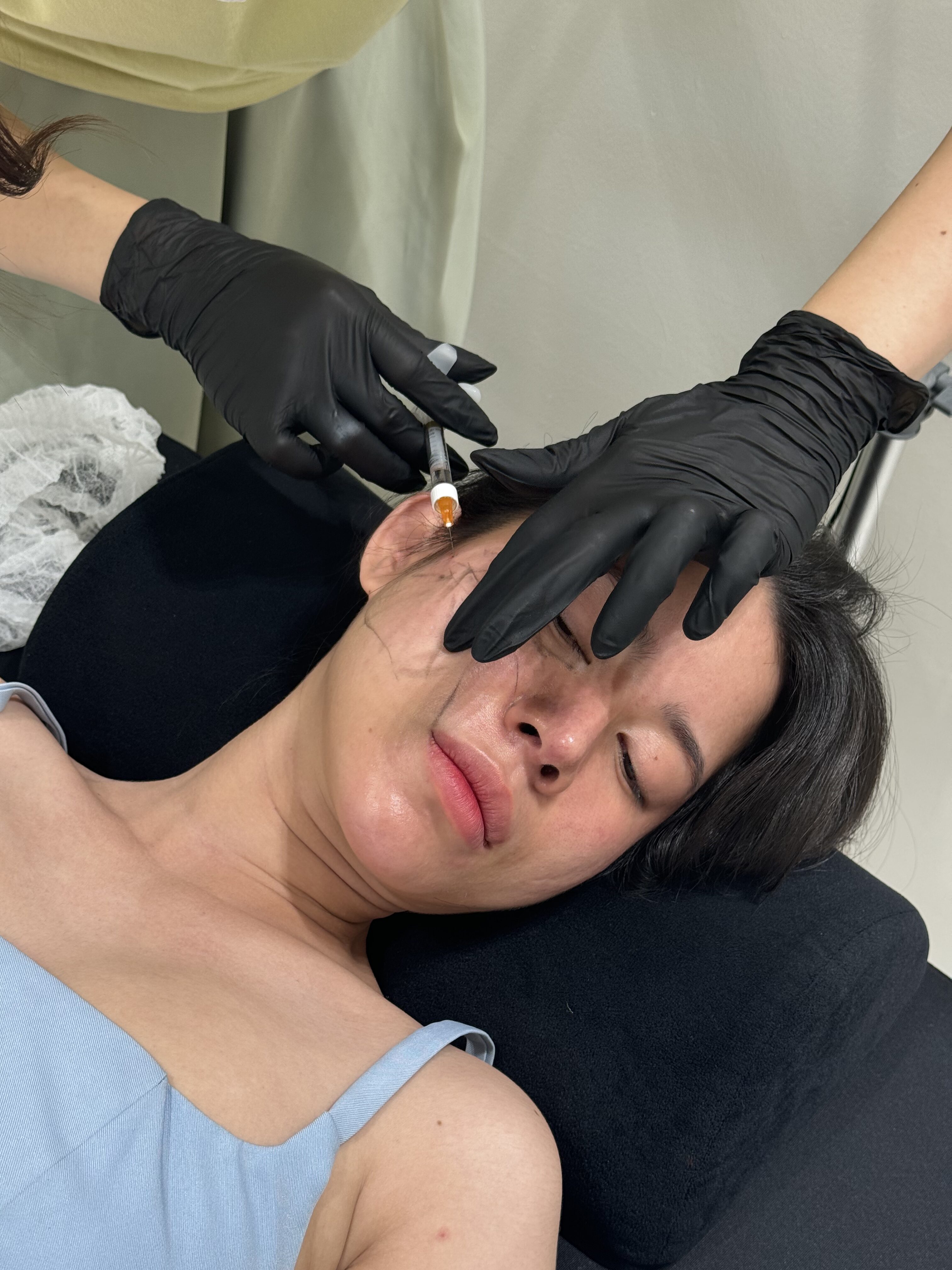 facial-slimming